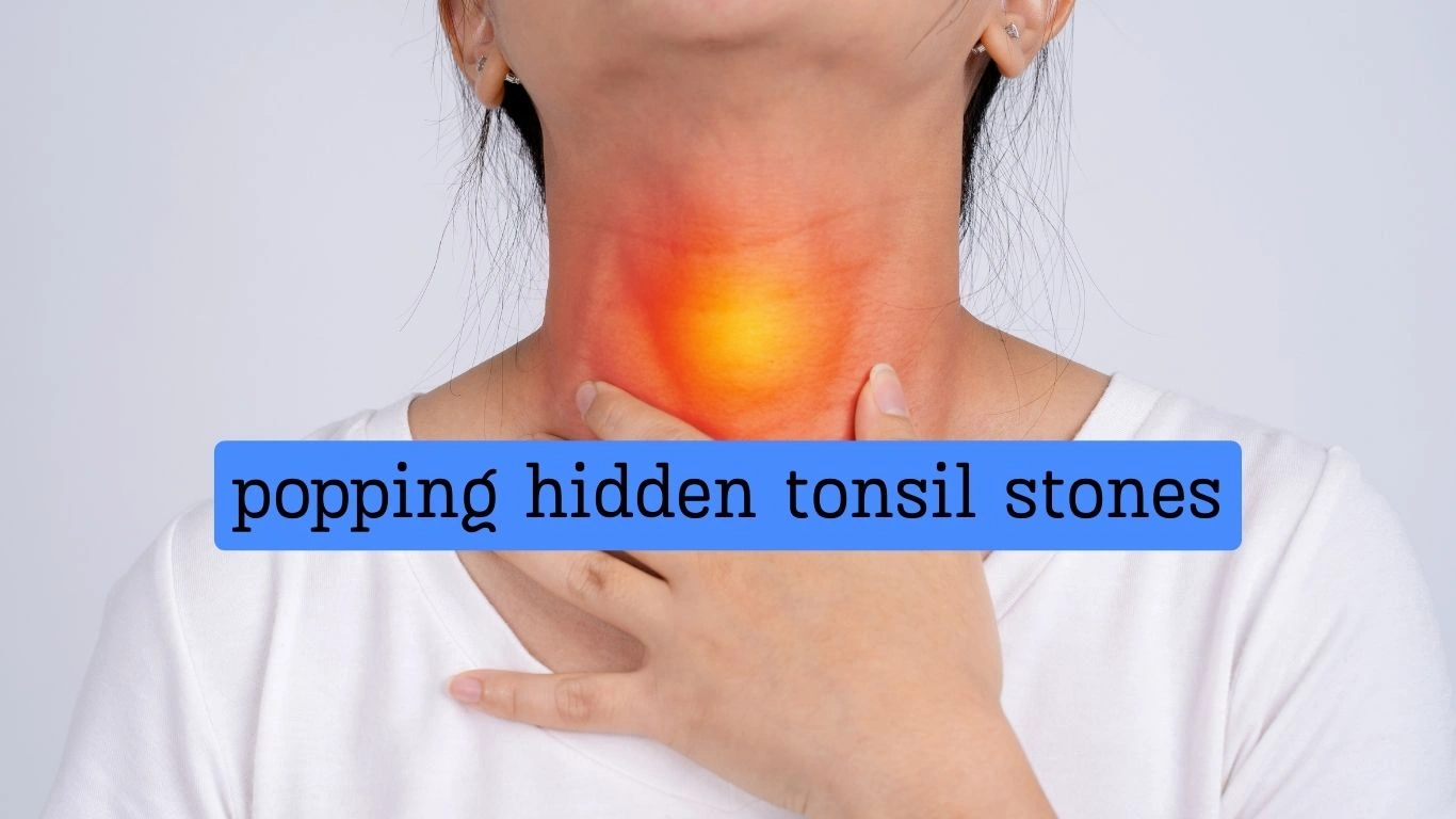 popping hidden tonsil stones