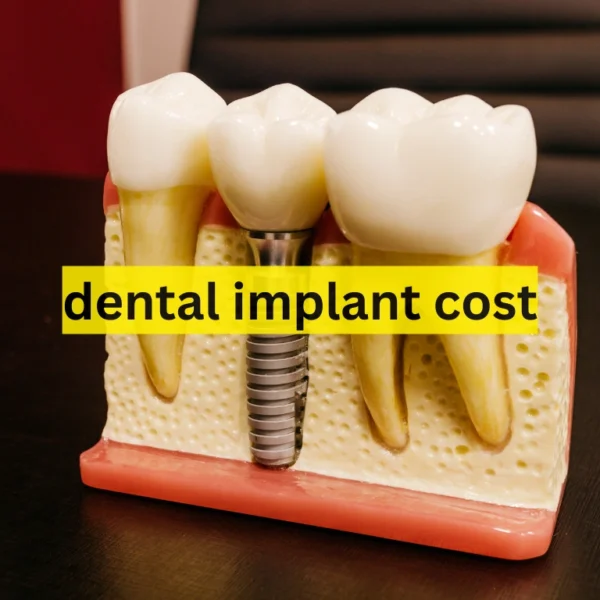 dental implant cost
