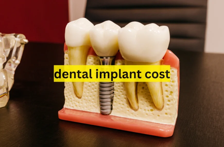 dental implant cost