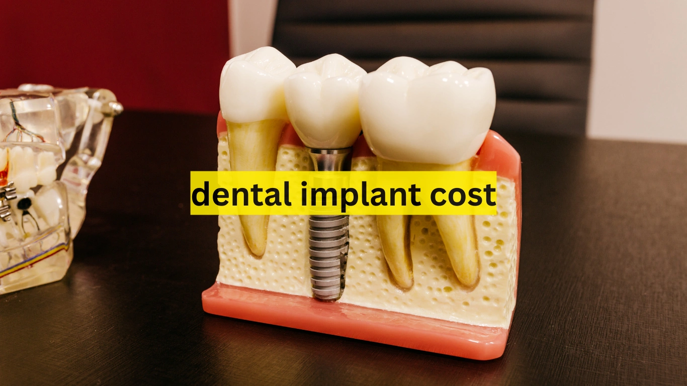 dental implant cost