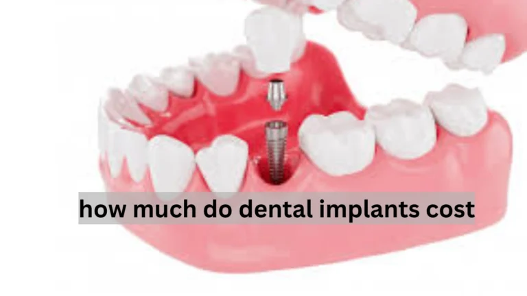 how much do dental implants cost