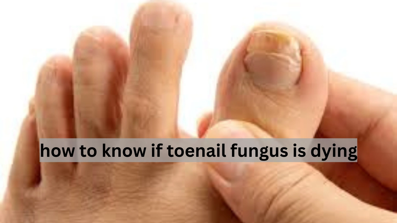 how to know if toenail fungus is dying